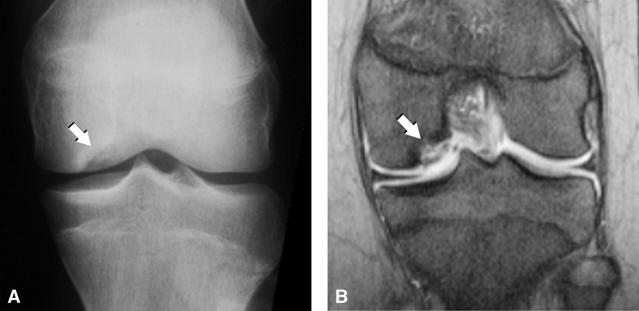 1-s2.0-S0363018807000540-gr27